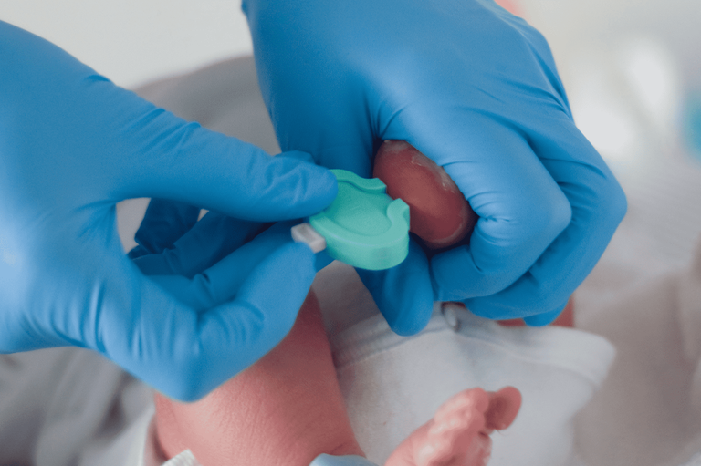 06092024 ebserh fibrose cística