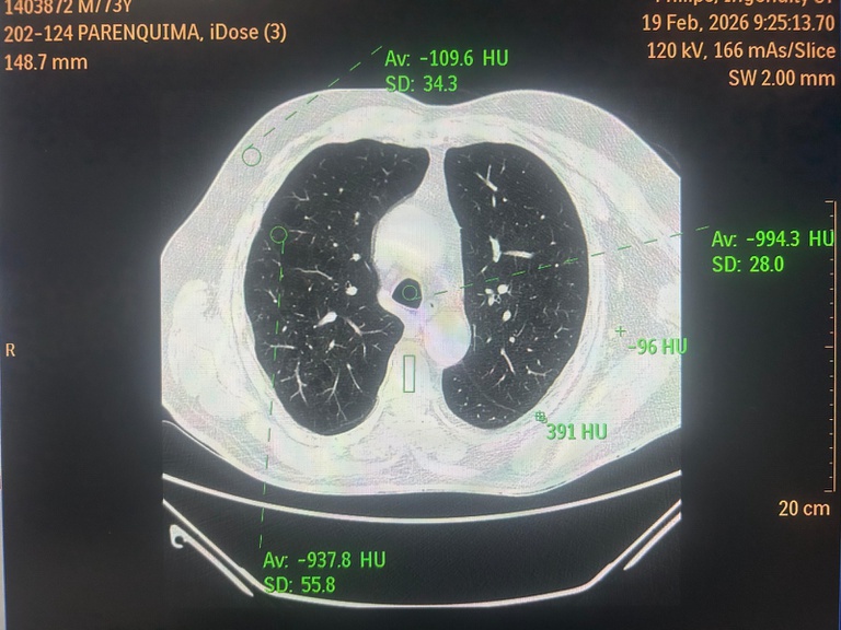 24022026 ebserh huuac-ufcg físico médico 3.jpeg