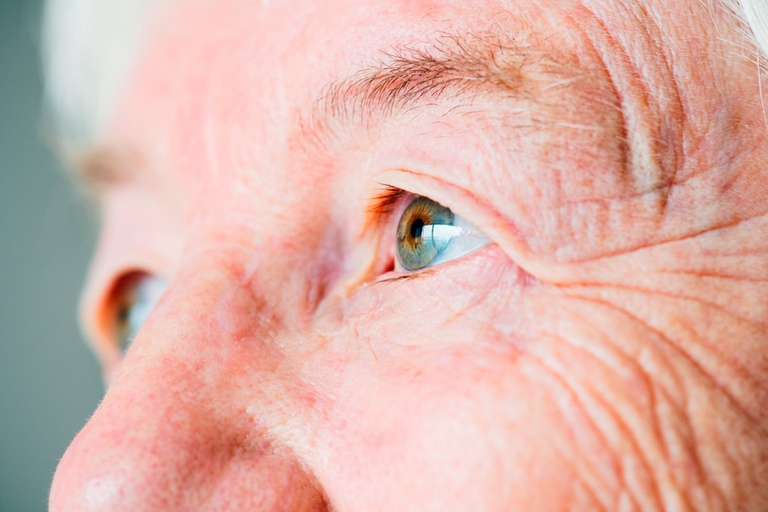 11032026 ebserh glaucoma 1.jpg