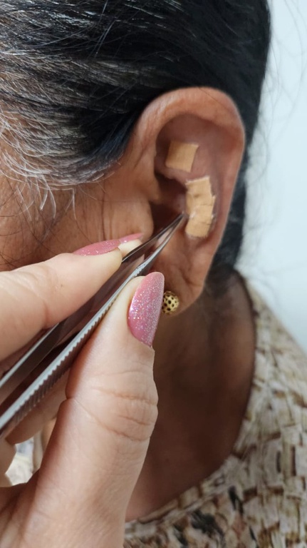 23012024 praticas integrativas ebserh 3.jpeg