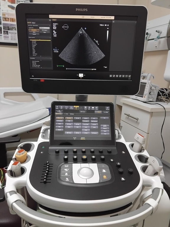 22052025 ebserh huap-uff novos equipamentos diagnóstico cardiovascular 2.jpg