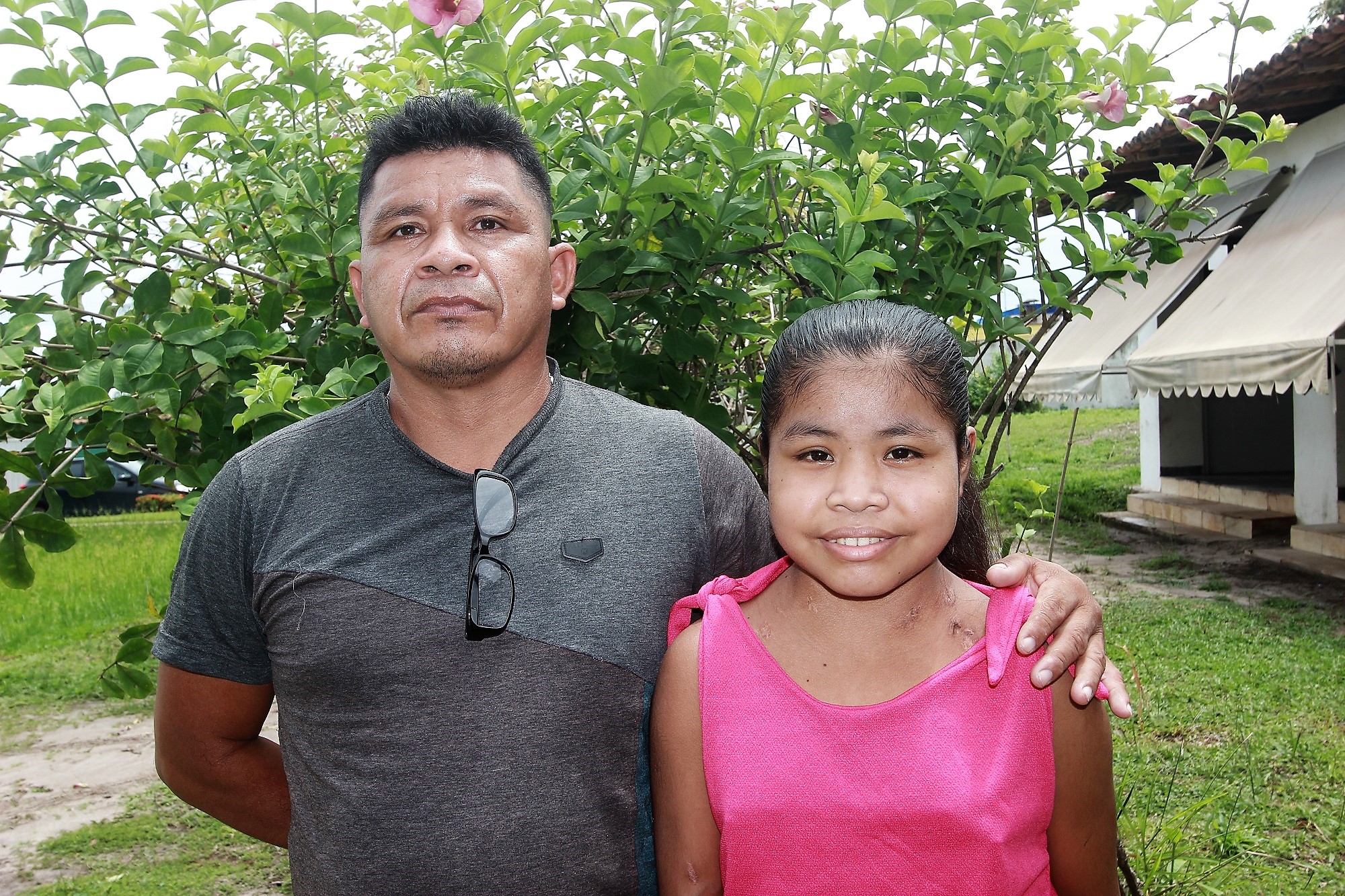 Ao lado de seu pai, Naiane Guajajara, segue na Casa de Saúde Indígena em São Luís para acompanhamento.