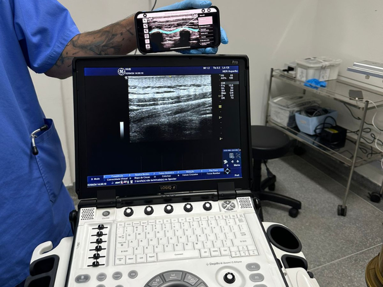 16042024 ebserh hub-unb aparelho ultrassonografia 2.png
