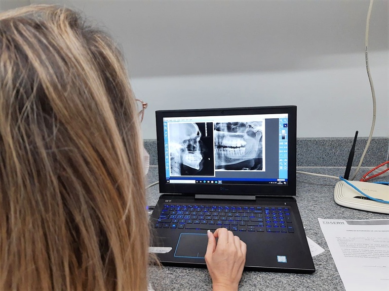 01.06.2022 _ HULW inaugura raio X panorâmico digital na odontologia (10).jpeg