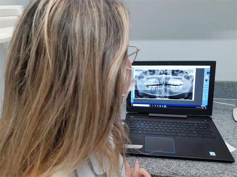 01.06.2022 _ HULW inaugura raio X panorâmico digital na odontologia (2).jpeg