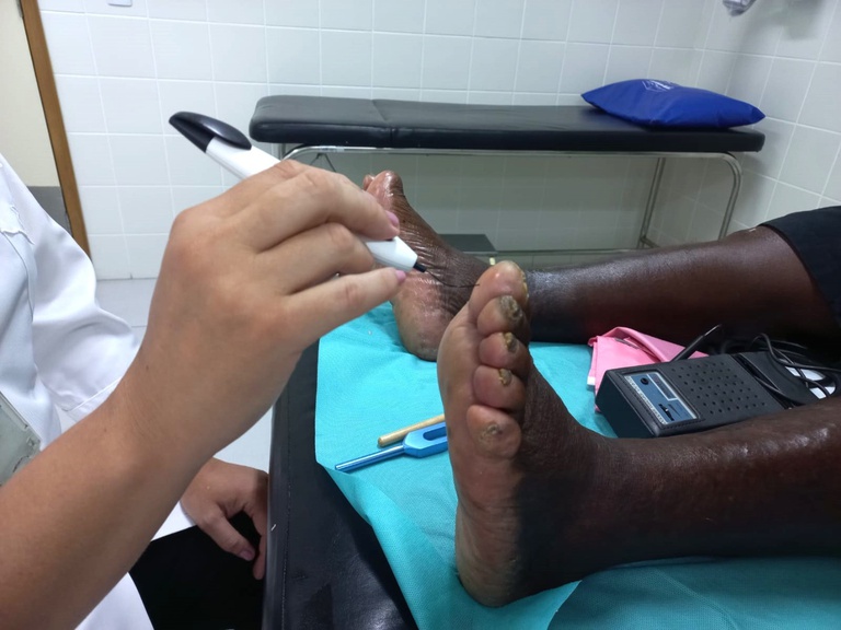 06022024 huap-uff podiatria ebserh 3.jpeg