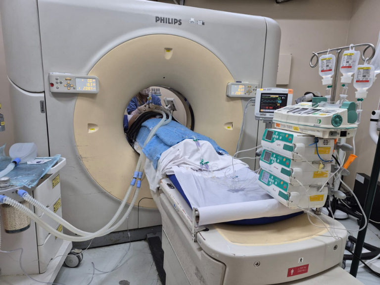 10112025 ebserh huap-uff ablação radiofrequencia 1.png