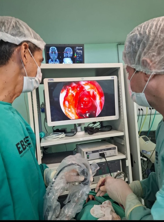 13082025 ebserh hu-ufpi cirurgia tumor cerebral 2.jpeg