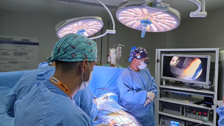 02022026 hucam-ufes cirurgia coração 10.jpeg