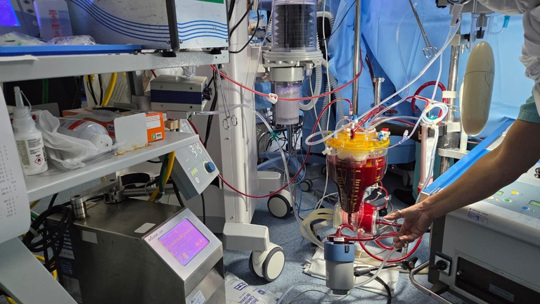 02022026 hucam-ufes cirurgia coração 5.jpeg