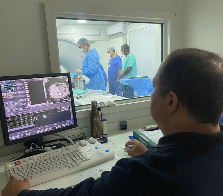 22072024 ebserh hucam-ufes procedimento metastase hepática 3.jpeg