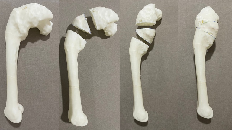 03012022 osso 3d - 1.jpg