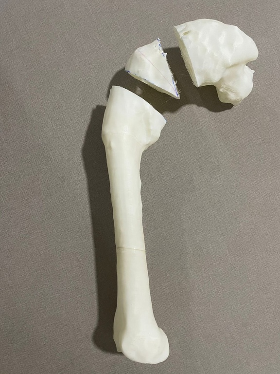 03012022 osso 3d - 3.jpeg