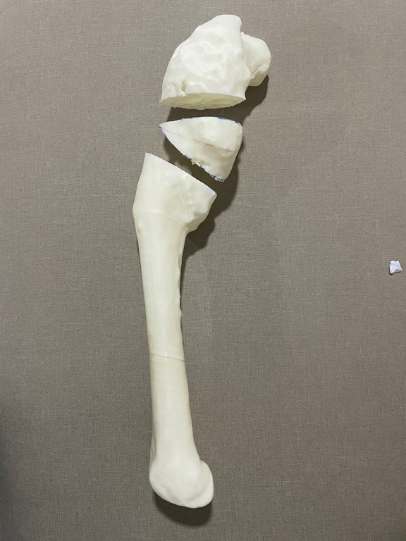 03012022 osso 3d - 4.jpeg