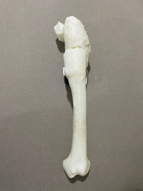 03012022 osso 3d - 5.jpeg