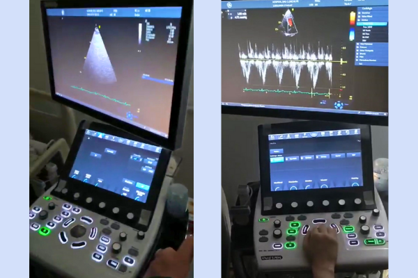 16052024 ebserh hc-ufpe ecocardiógrafo 2.png