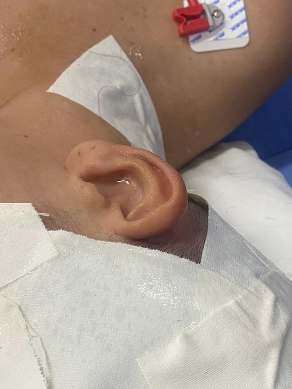 02042026 hu brasil hulw-ufpb cirurgia 3.jpeg