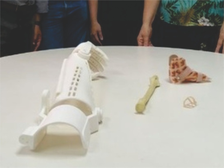 28122020 órtese 3D humap.jpeg