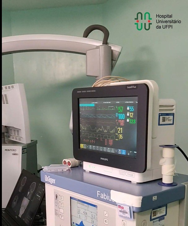 29032022 hu ufpi cirurgia coluna 3.jpeg