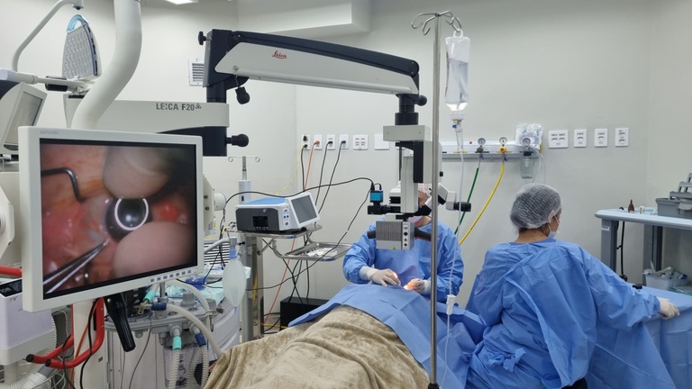 03102025 ebserh hucam-ufes transplante córnea 2.jpeg