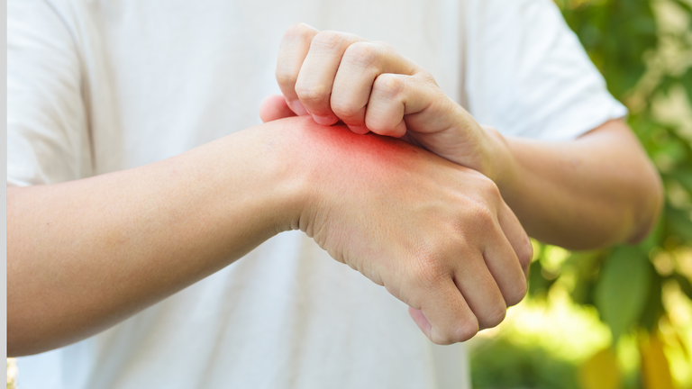 25042024 Luta contra a malária 99% dos casos da doença no Brasil estão na região amazônica 2.png