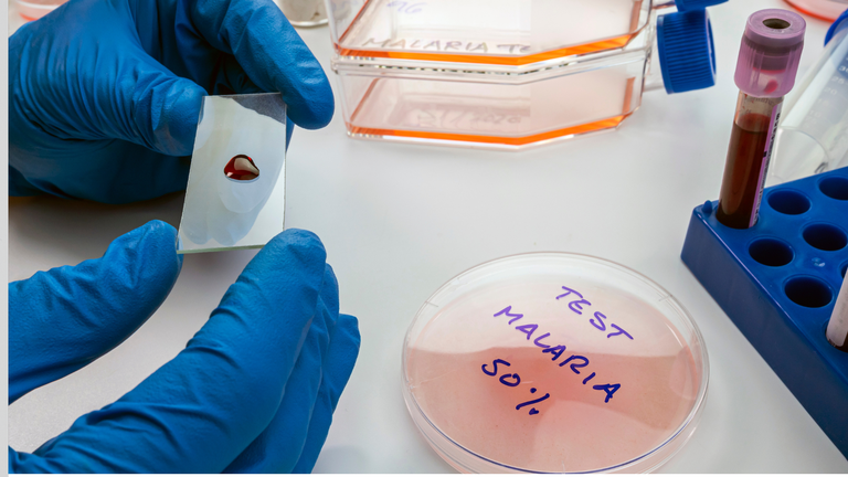 25042024 Luta contra a malária 99% dos casos da doença no Brasil estão na região amazônica 3.png