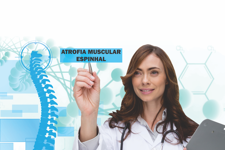 atrofia muscular.png