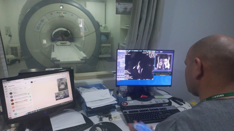 04042025 HUGV-Ufam conclui ações do programa “Ebserh em Ação” com saldo positivo em procedimentos e exames no SUS 4.jpeg