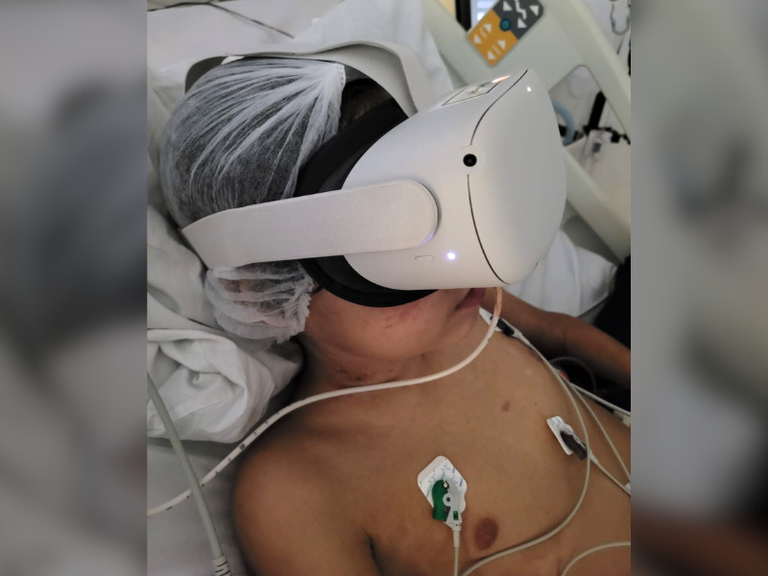 01112024 ebserh huap-uff óculos realidade virtual 3.png