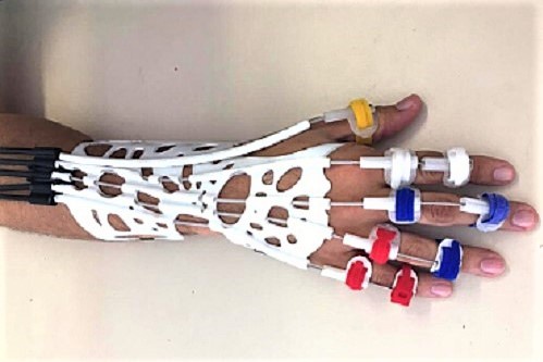 02102020 órtese huol.jpg