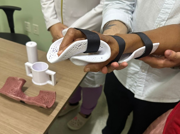 25082025 ebserh hdt-uft órtese 3D 1.jpeg