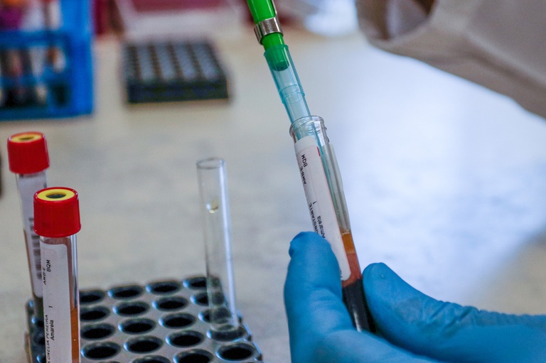 14092020 pesquisa efeitos covid hu-ufsc.jpg