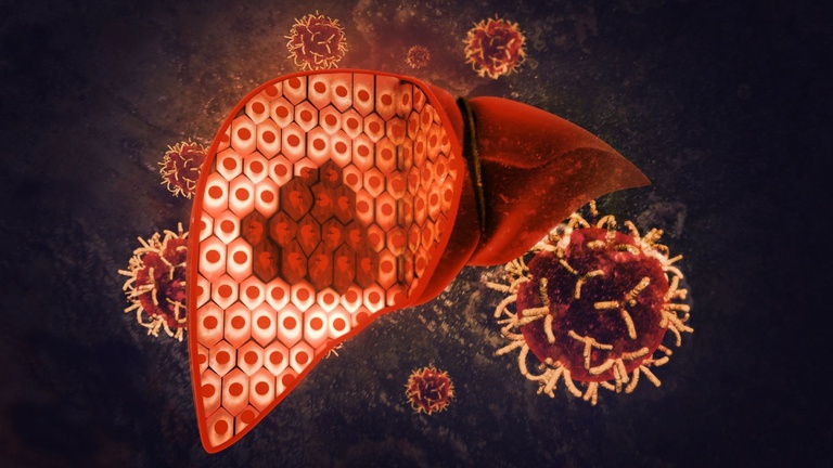 11012021 uftm câncer Figado