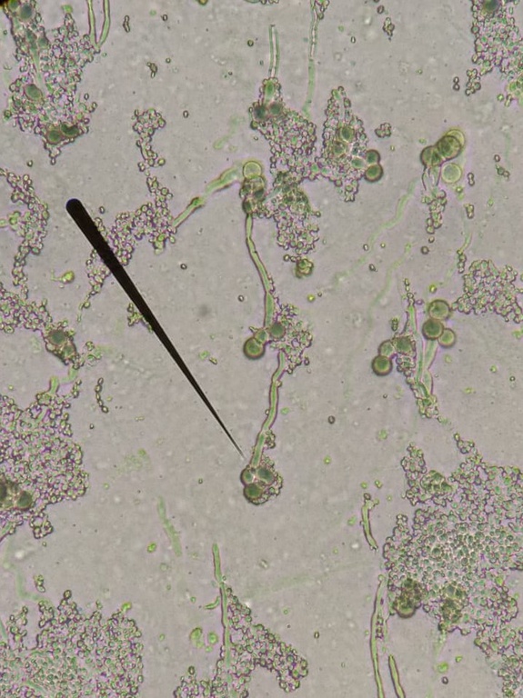 fungo pesquisa multicentrica ebserh