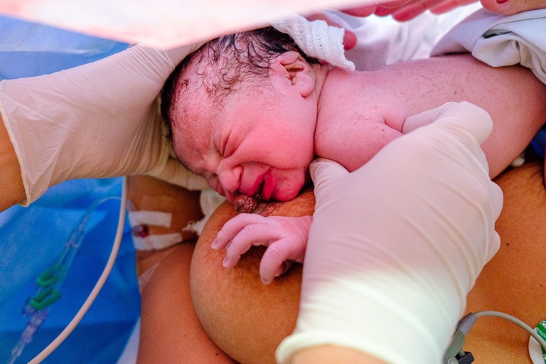 18082021 Agosto Dourado Hucam-Ufes 4.jpeg