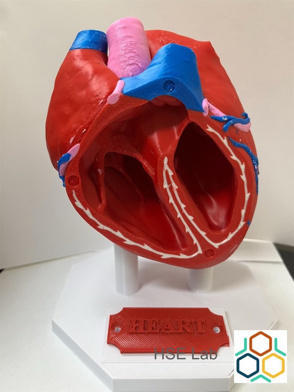 02082024 ebserh implante 3d 3.jpg