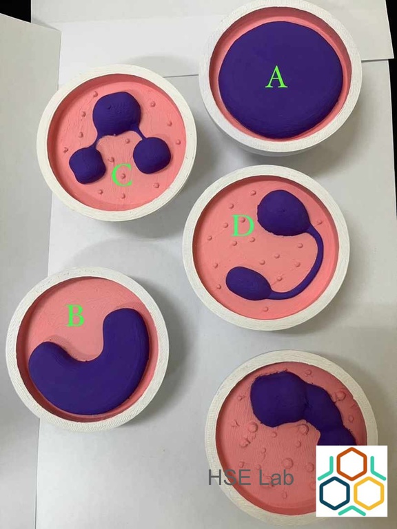 02082024 ebserh implante 3d 5.JPG