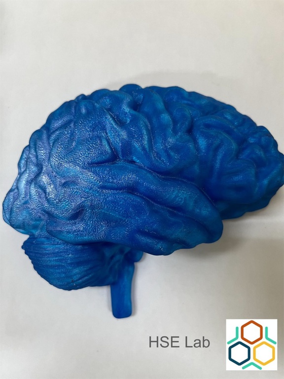 02082024 ebserh implante 3d 6.jpg