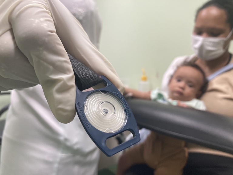 20202022 fibrose cistica teste do suor.jpeg