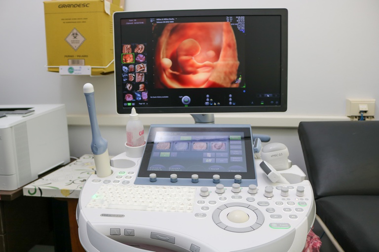 03102023 hujm-ufmt equipamento ultrassonografia CAPA.jpeg