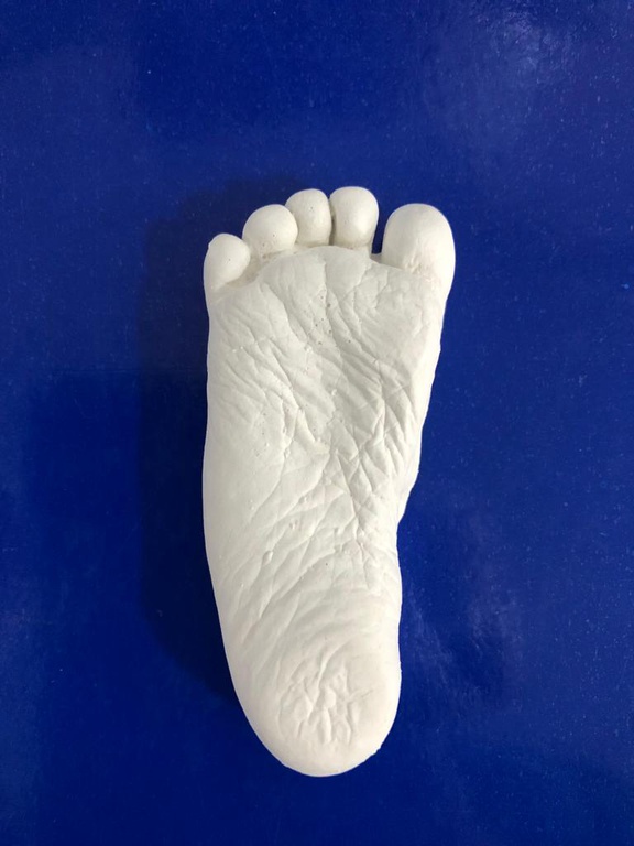 Cuidados Paliativos - UTI Neonatal - Pezinho de gesso do bebê - foto 2.jpeg