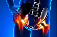 Processo seletivo para treinamento avançado em Ortopedia - Cirurgias do Quadril