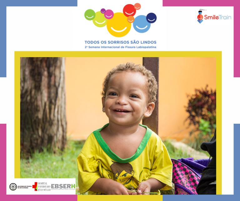 labio palatino 29-09.png