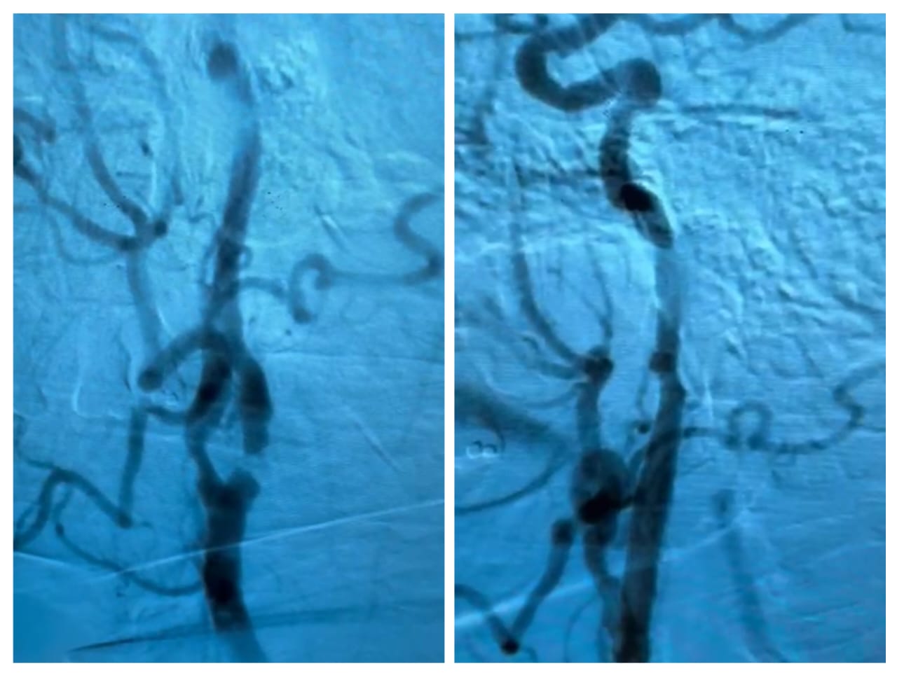 Antes e depois do procedimento