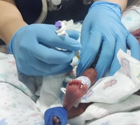 HU-UFMA integra estratégia do SUS e amplia prevenção contra bronquiolite em bebês