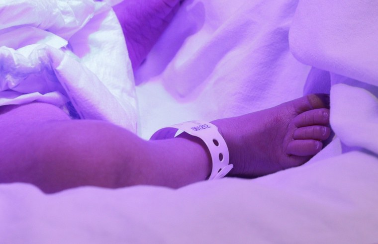 HU-UFMA apresenta experiência de destaque em normotermia neonatal em simpósio internacional