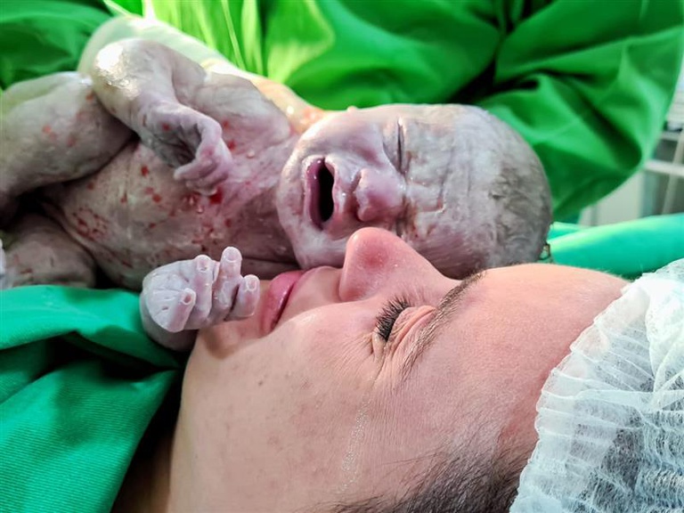 04 Gesto de gentileza do anestesista Nilfácio vira registro emocionante de mãe e filha (2).jpeg