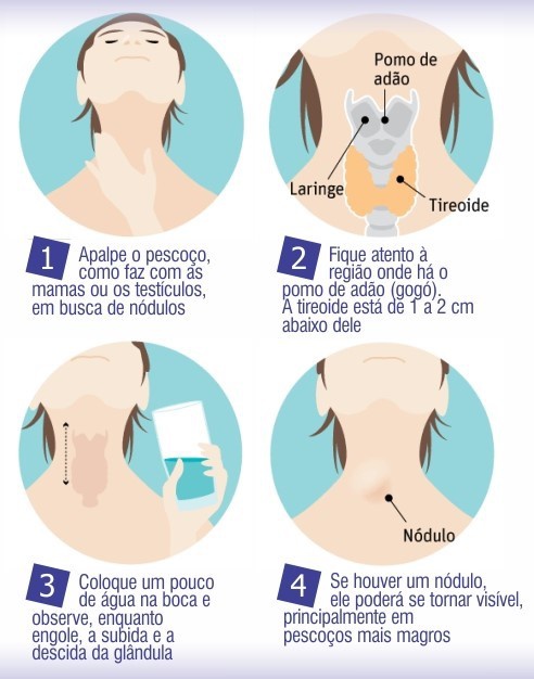 auto-examedetireoide