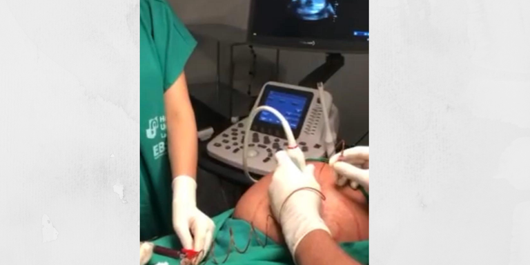 Transfusão Fetal Intrauterina