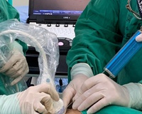 HUPAA realiza primeira biópsia renal infantil guiada por ultrassonografia